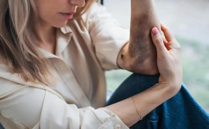 شهد 2024 مقتل نحو 50 ألف امرأة وفتاة معظمهن على يد أقاربهن - غيتي