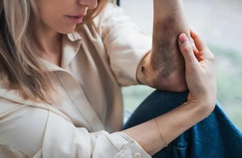 شهد 2024 مقتل نحو 50 ألف امرأة وفتاة معظمهن على يد أقاربهن - غيتي